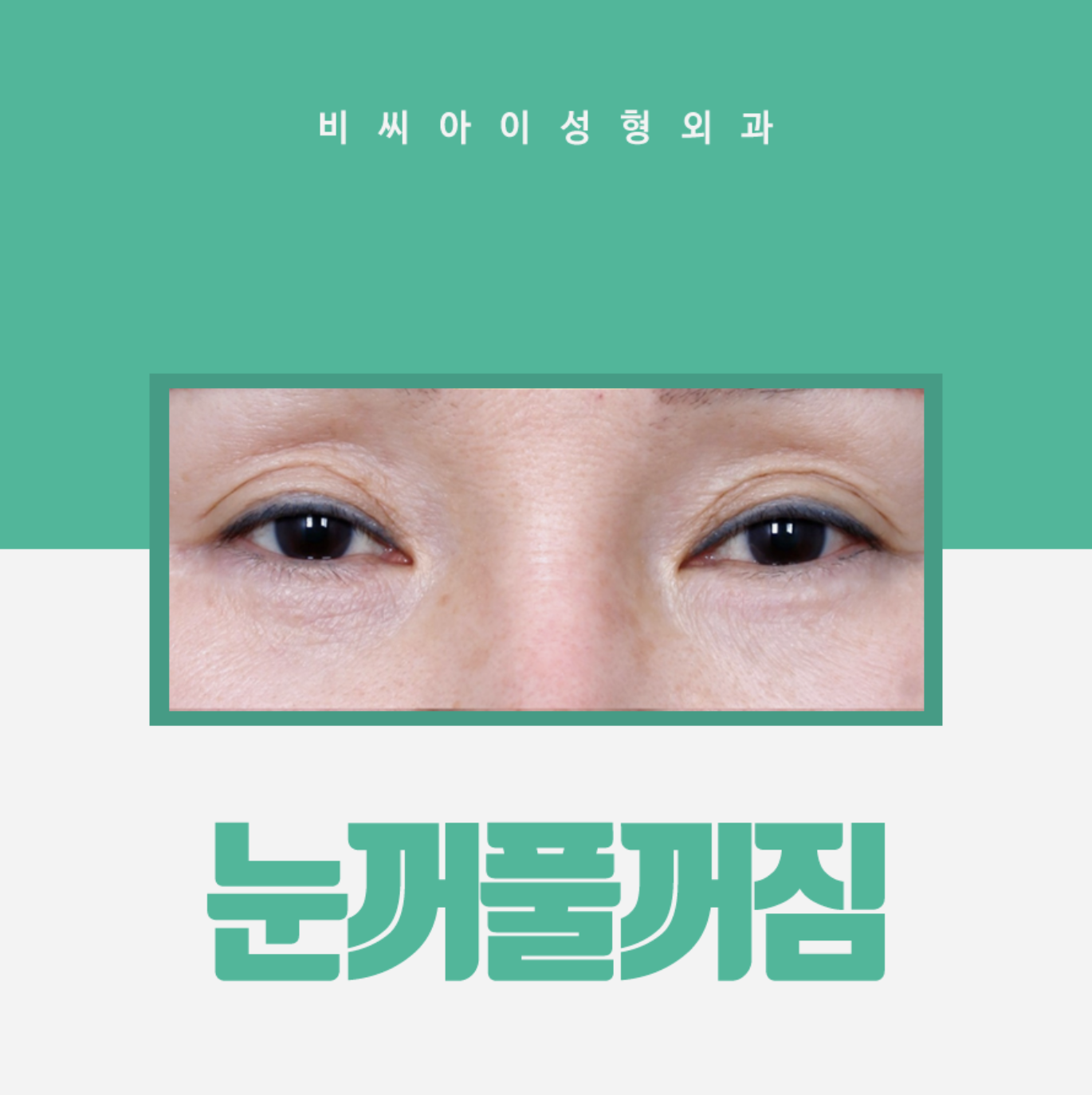 눈꺼풀을 어려 보이게 만드는 방법 7