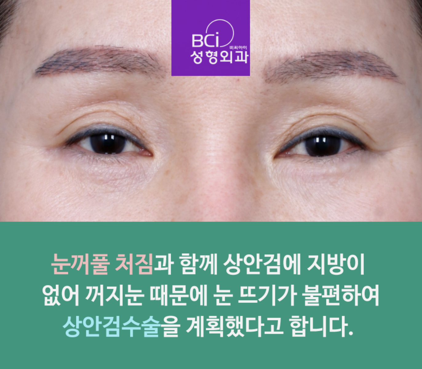 눈꺼풀을 어려 보이게 만드는 방법